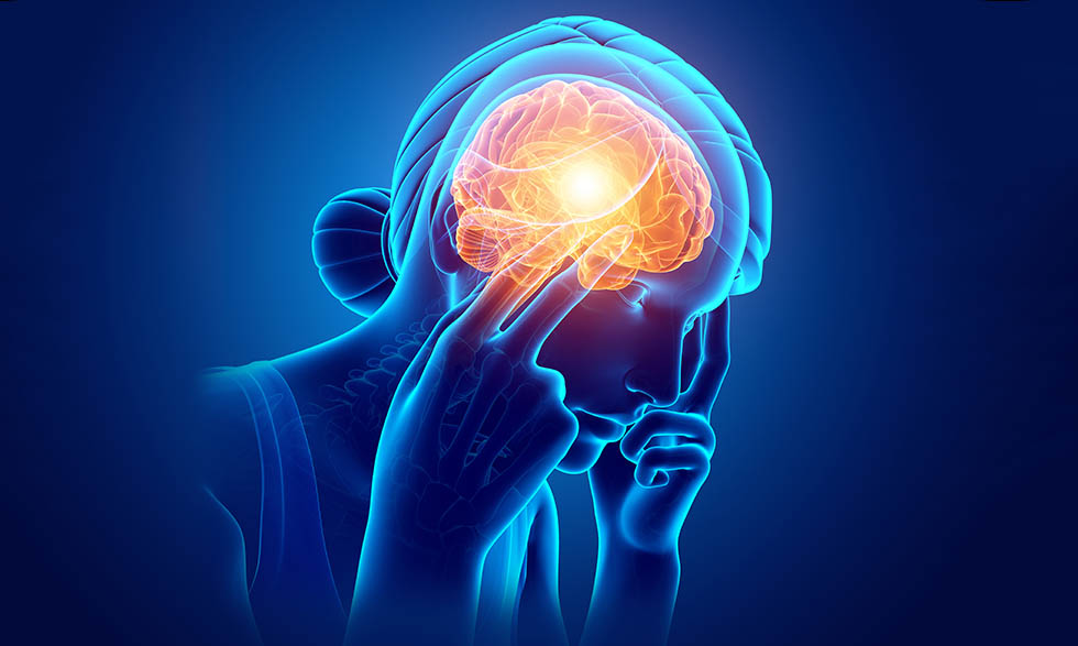 headache migrein Migraine Headache