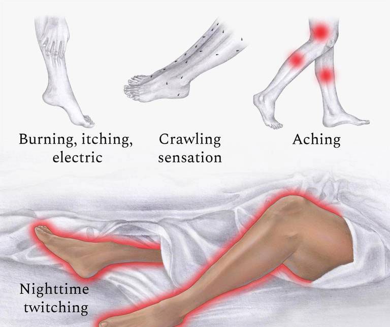 Restless Leg Syndrome and Mineral Water